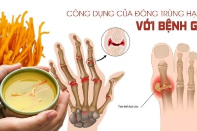 Tác dụng của đông trùng hạ thảo với người bệnh gút (gout)