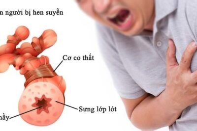 Người bị hen suyễn có nên dùng đông trùng hạ thảo không?